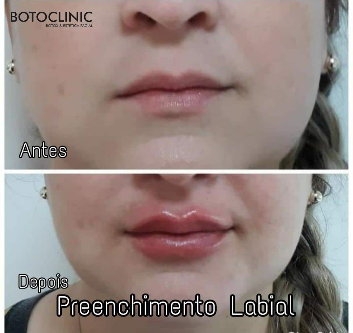 Botoclinic Clínica de Estética