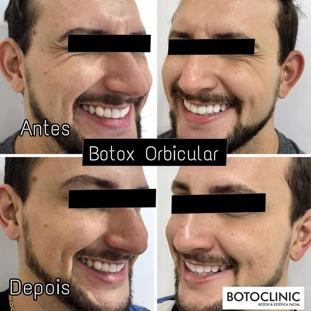 Botoclinic Clínica de Estética