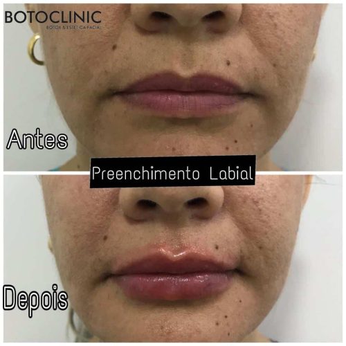 Botoclinic Clínica de Estética