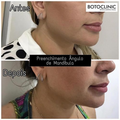 Botoclinic Clínica de Estética