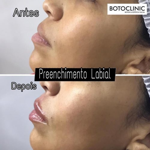 Botoclinic Clínica de Estética