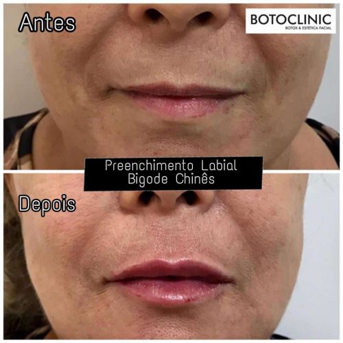 Botoclinic Clínica de Estética