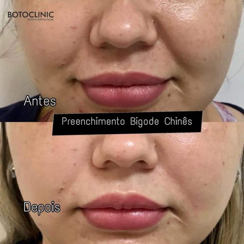 Botoclinic Clínica de Estética