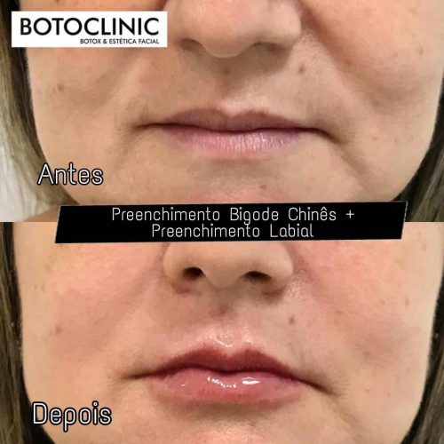 Botoclinic Clínica de Estética