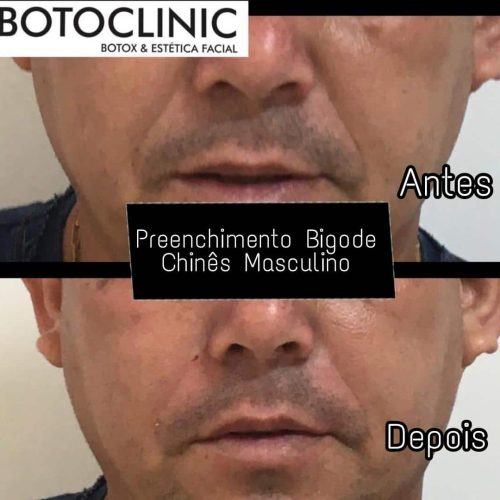 Botoclinic Clínica de Estética