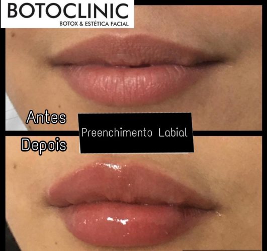 Clínica Botoclinic – Procedimentos Estéticos Botoclinic Clínica de Estética