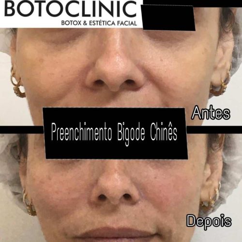 Botoclinic Clínica de Estética