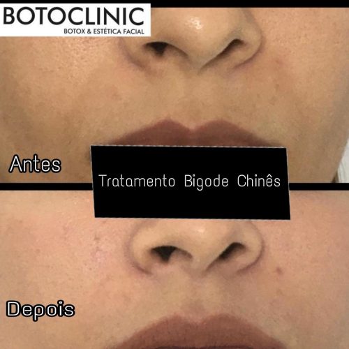 Botoclinic Clínica de Estética