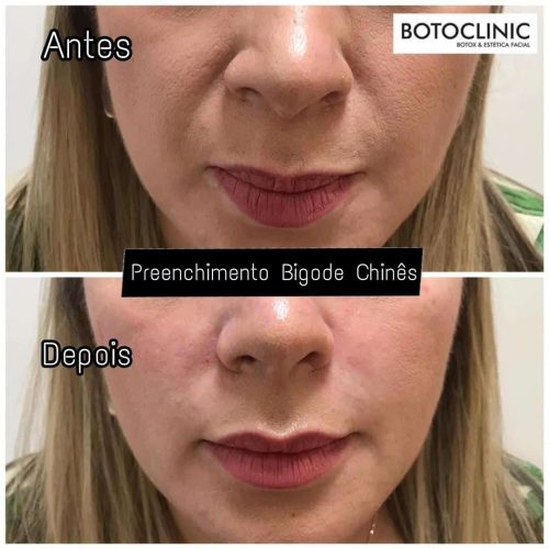 Botoclinic Clínica de Estética