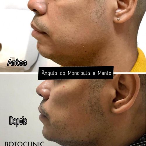 Botoclinic Clínica de Estética