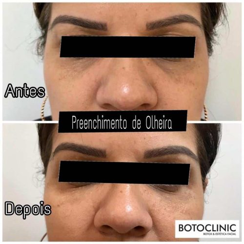 Botoclinic Clínica de Estética