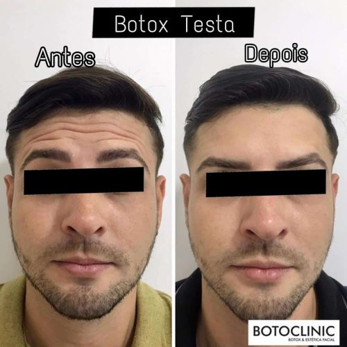 Botoclinic Clínica de Estética