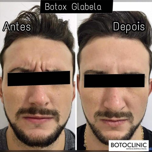 Botoclinic Clínica de Estética