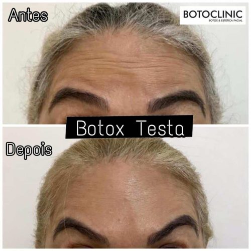 Botoclinic Clínica de Estética