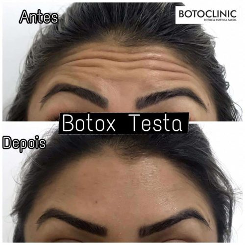 Botoclinic Clínica de Estética