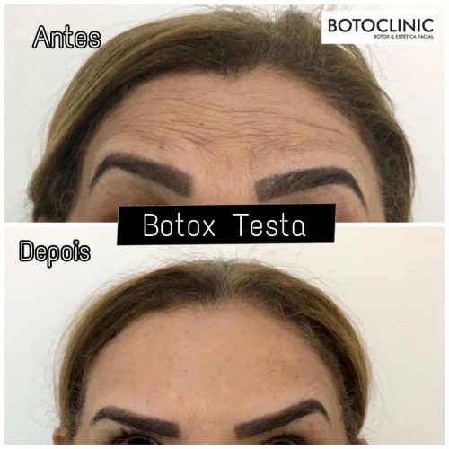 Botoclinic Clínica de Estética