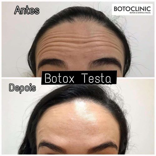 Botoclinic Clínica de Estética
