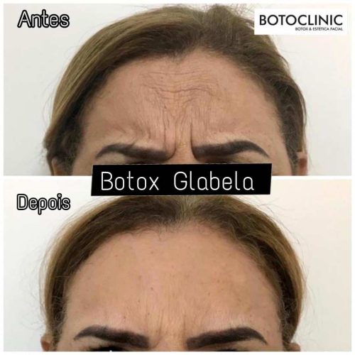 Botoclinic Clínica de Estética