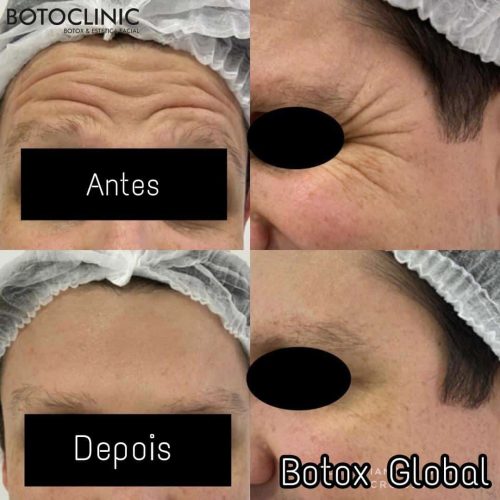 Botoclinic Clínica de Estética