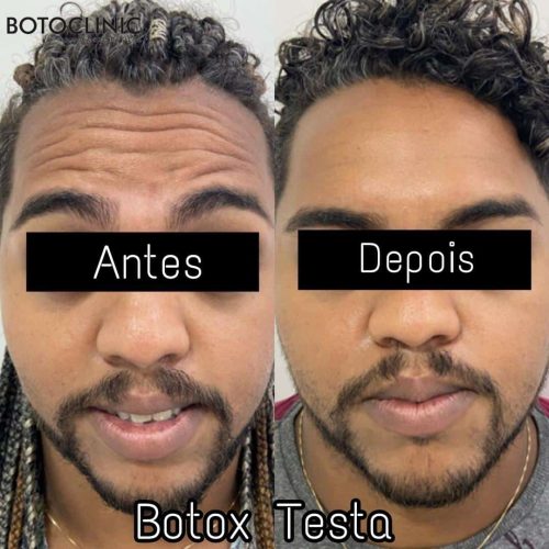 Botoclinic Clínica de Estética