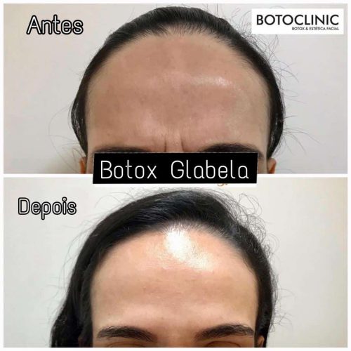 Botoclinic Clínica de Estética