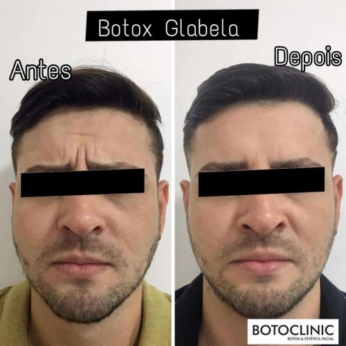 Botoclinic Clínica de Estética