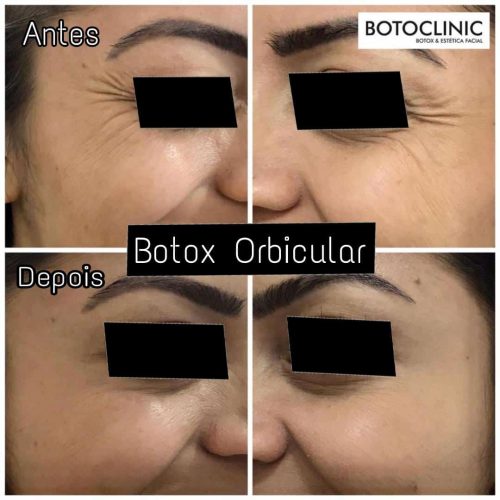Botoclinic Clínica de Estética