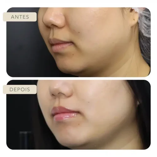 Botoclinic Clínica de Estética