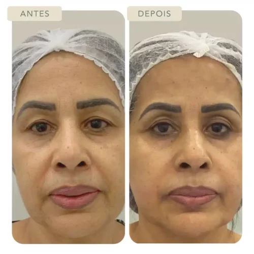 Botoclinic Clínica de Estética