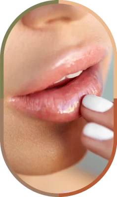 Hidragloss Botoclinic Clínica de Estética