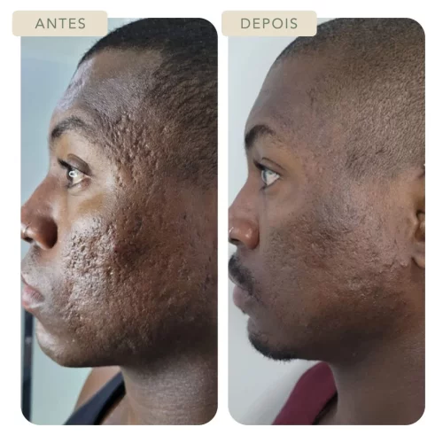 Clínica Botoclinic – Procedimentos Estéticos Botoclinic Clínica de Estética