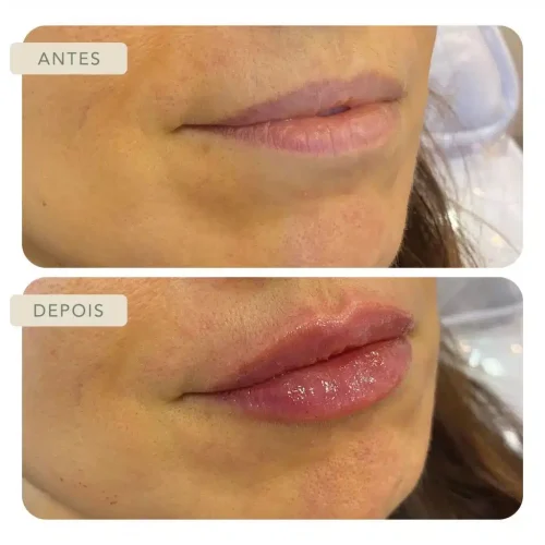 Botoclinic Clínica de Estética