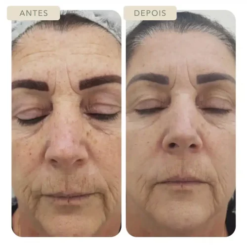 Botoclinic Clínica de Estética